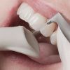 Чистка зубов AirFlow в стоматологии Дент Престиж